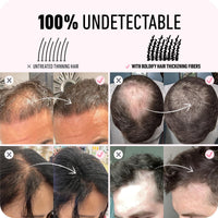 Boldify BOLDIFY Hair Fibres for Thinning Hair (DARK AUBURN) - 28g Bottle - Undetectable & Natural Hair Filler Instantly Conceals Hair Loss - Hair Powder Thickener, Topper for Fine Hair for Women & Men