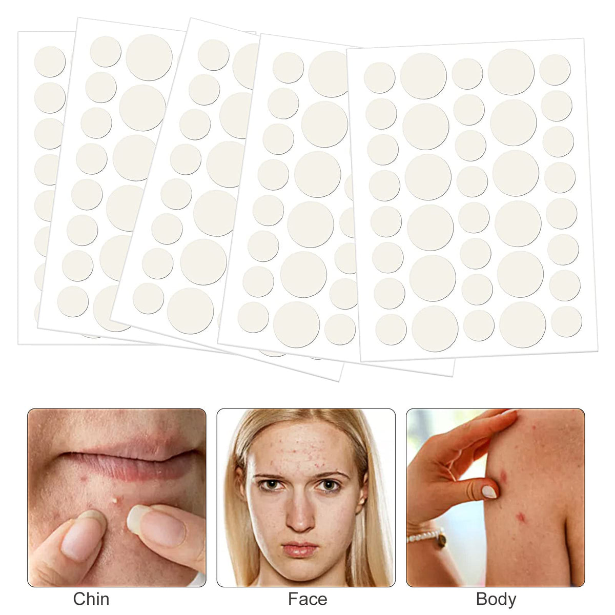 Udewo 252PCS Pimple Patches Acne Healing Patches Spot Treatment Sticker Absorbing Pimple Patches Translucent Hydrocolloid Patches Acne Stickers Invisible Spot Patches Blemish Stickers for Face and Body