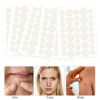 Udewo 252PCS Pimple Patches Acne Healing Patches Spot Treatment Sticker Absorbing Pimple Patches Translucent Hydrocolloid Patches Acne Stickers Invisible Spot Patches Blemish Stickers for Face and Body