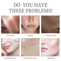 Kojic Acid Serum - Collagen Face Serum for Skin Lig_htening - Anti Aging Face Serum - Dark Spot Correcting Glow Serum - Hydrating Serum - Facial Serum for Firming, Moisturising, Nourishing (30ml)