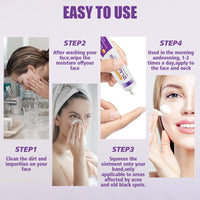 Azelaic Acid Cream, Azelaic Acid Face Serum Cream, Brightening Face Skin Care Treatment for All Skin Types, Repair Dark Spots for Fresher and Smoother Skin, (20g)