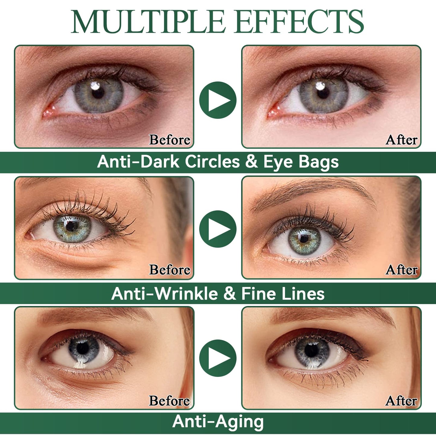 Under Eye Patches, Aloe Vera Eye Masks for Puffy Eyes, Under Eye Masks, Dark Circles Under Eye Treatment Women, Improve Under Eye Bags, Fine Lines and Wrinkles, Eye Masks Skincare, 30 Pairs