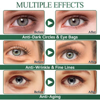 Under Eye Patches, Aloe Vera Eye Masks for Puffy Eyes, Under Eye Masks, Dark Circles Under Eye Treatment Women, Improve Under Eye Bags, Fine Lines and Wrinkles, Eye Masks Skincare, 30 Pairs