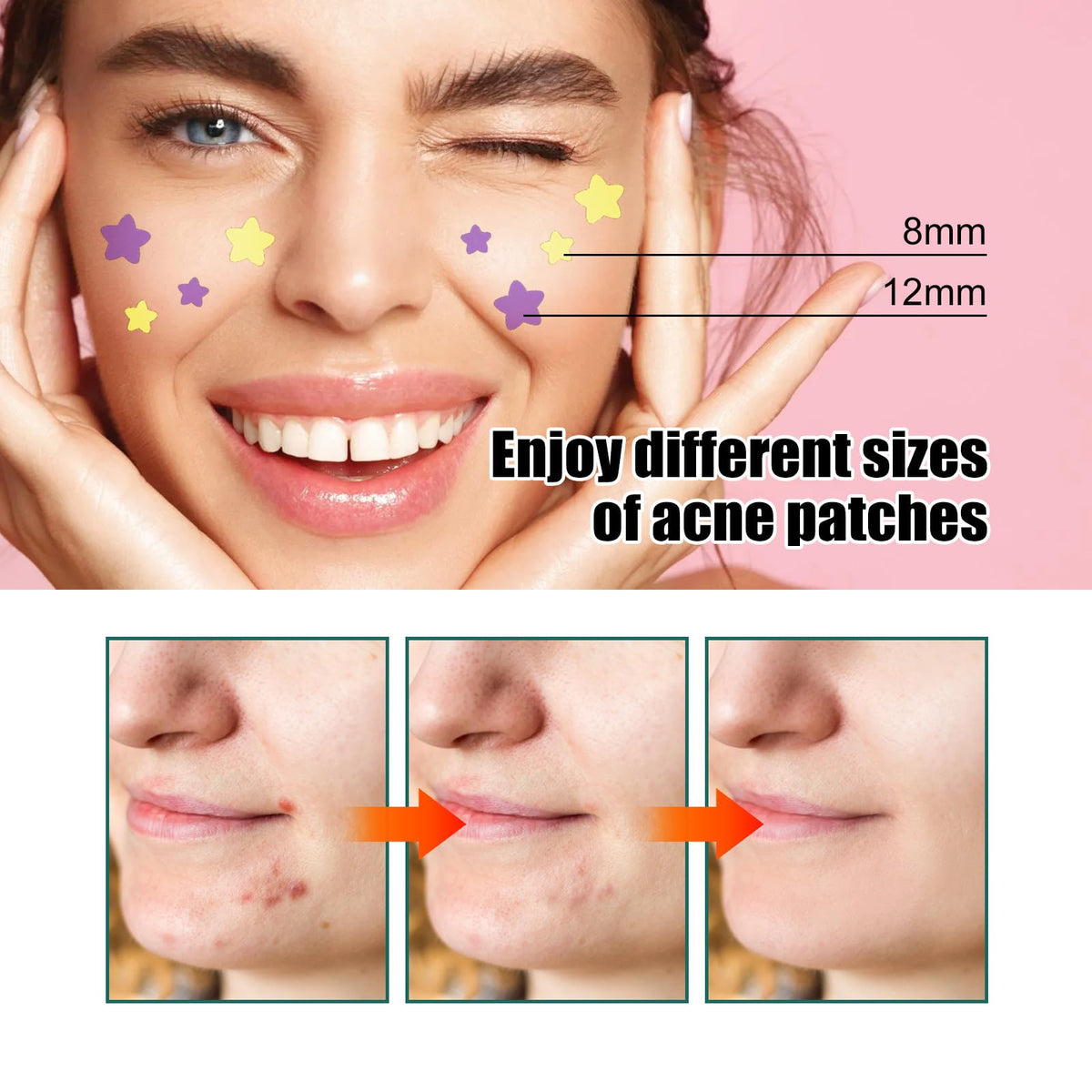 DERDOUT 1 Acne Patch Star, Tea Tree Oil Spot Sticker, Water Colloidal Patch for Acne, Flaws, and Facial Acne (112 dots, 8mm and 12mm)