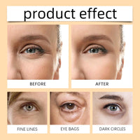 2PCS Lumibalm for Under Eye Bags & Puffiness,Stick for Dark Circles,Lumibalm Erases E/ye Bags,Turmeric Retinol E/ye Cream Stick,Lumibal/m Stic/k,Hydrating Eye Balm Sti/ck,Lumib/alm Ey/e Serum