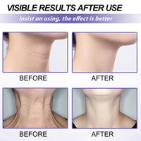 Tighten and Lift Neck Cream,Neck Firming Cream for Sagging Skin,Neck Tightening Cream with Collagen,Firming Cream for Loose Skin,Tighten & Lift Firming Neck Cream,Anti Aging Neck Cream-50ML