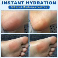 Generic Urea Foot Cream with Salicylic Acid – Heel Stick for Cracked Feet, Repairs Dry Rough Heels Fast, Intensive Moisturizer for Dead Skin, Hydrating Heel Balm with Urea for Smooth -Looking Feet