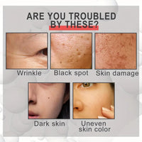 Whitening Freckle Cream,Moisturizing Removes Facial Dark Spots,Dark Spot Remover,Spot Removal Treatment Cream,Sp/ot Off Freck/le Whitening Crea/m,Anti wrinkle Moisturizing Fre/ckle Remover Cre/am