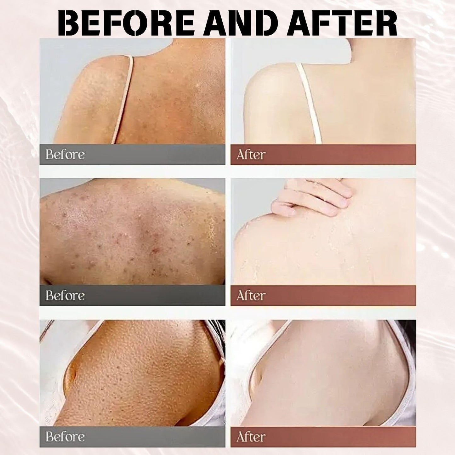 Strawberry Legs Treatment Cream – Body Cream for Strawberry Skin, Dry Skin Moisturiser with Exfoliating & Smoothing Formula, Foot Product for Very Dry Feet, Body Skin Care Lotion for Women & Men