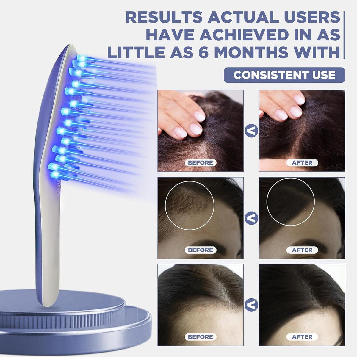 MOJMBSBY Electric Phototherapy Scalp Massager Comb for Hair Growth,Hair Regrowth Brush for Her Him Gifts,USB Anti Hair Loss Head Care Electric Comb Brush for Mother