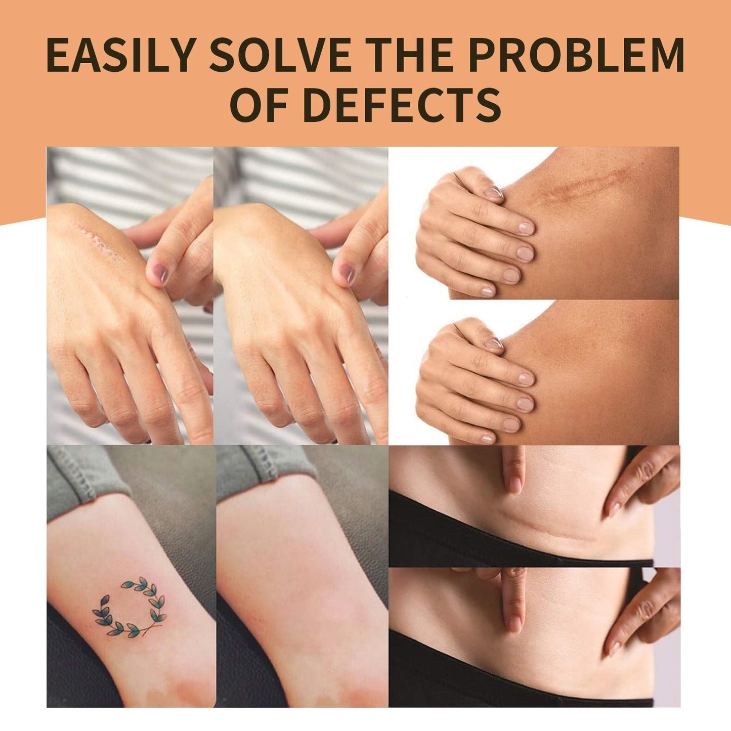 Pothenika Tattoo Cover Up Patch, 15 PCS Scar Cover Up Sticker, Waterproof Tattoo Cover Up Tape Invisible Concealer Sticker, Natural Skin Scar Cover Breathable Body Sticker, Scar Patches