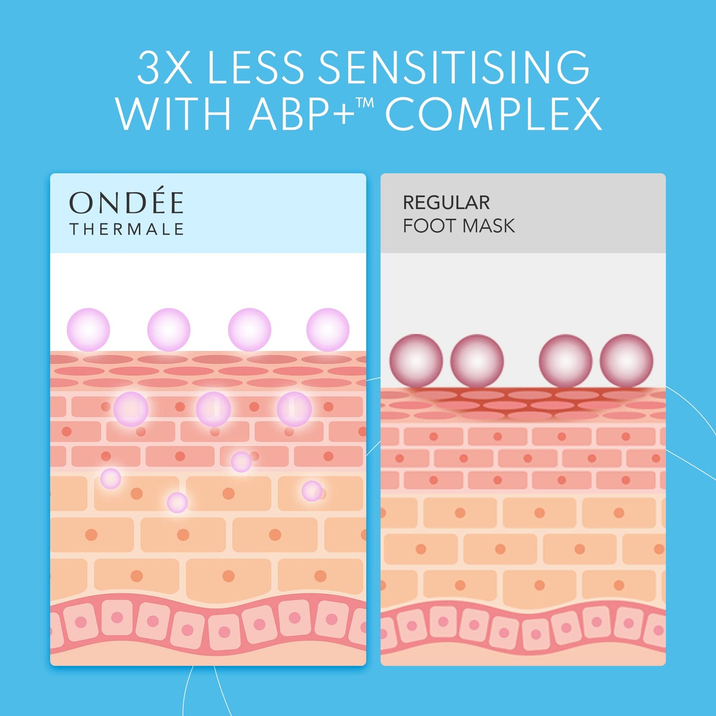 Ondée Thermale Foot Peel Mask - Exfoliating Foot Masks, Moisturising Foot Mask with Vitamin E, Foot Peel Mask for Hard Skin, Callus and Cracked Heels - Foot Care Foot Mask Peel, 1 Foot Pack