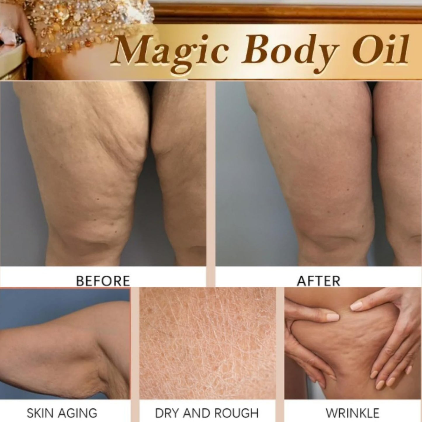 jinyue Glow Remedy O-il,Glow Remedy O-il Skin Tightening,Magic Body Firming Oil,Magic Luxury Body Firming Oil for Saggy Skin,Reduces Wrinkles, Fine Lines & Stretch Marks, 100ml