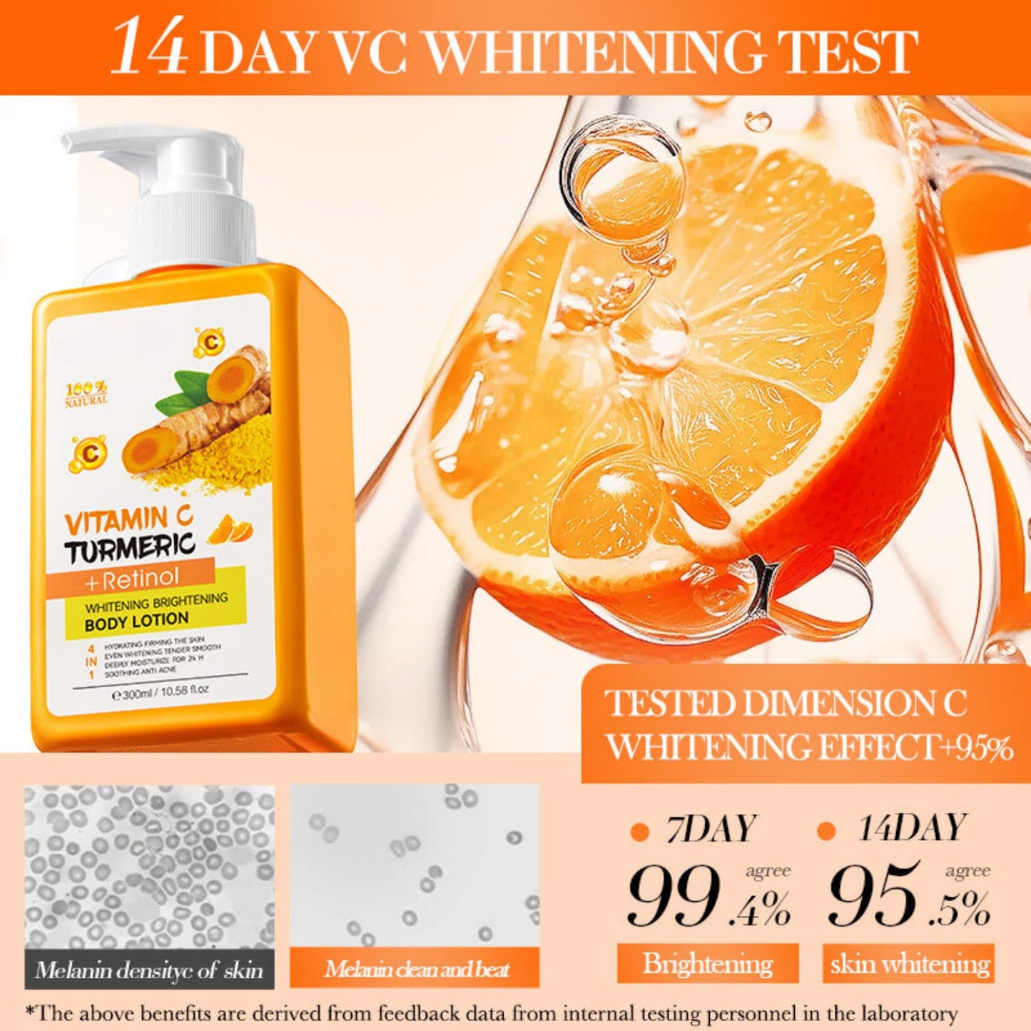 Turmeric & Vitamin C Body Lotion - Multi-Purpose Body Lotion - Turmeric,Vitamin C with Retinol Cream - Large-Capacity Body Moisturizer for Dry Skin - Remove Dark Spots,Smooth,Bright Skin 300ml
