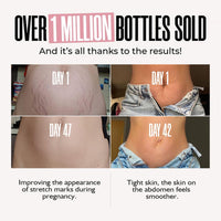 INSKIN B Flat Belly Firming Cream - Skin Firming and Tightening Body Cream Skin Tightening Moisturizing Body Tightening Cream for Tummy, Thighs, Arms, Butt - Stretch Mark