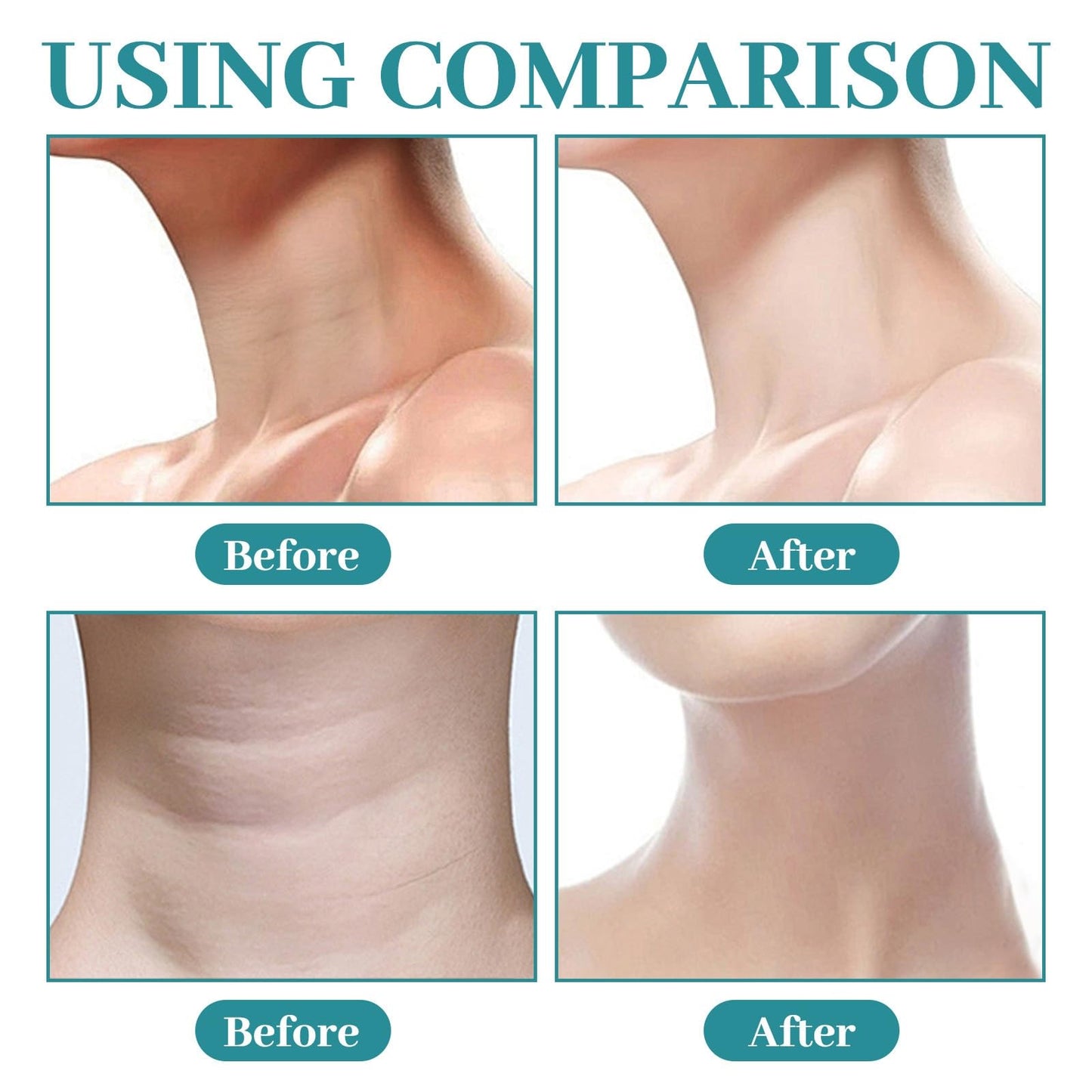 Cureluxe Crepe Be Gone Neck Cream - Crepe Be Gone Body Souffle - Neck Firming Cream - Ultra Hydrating Skin Firming Crea_m for Chest,Arms & Legs - Body Cream for Deep Hydration (85g)