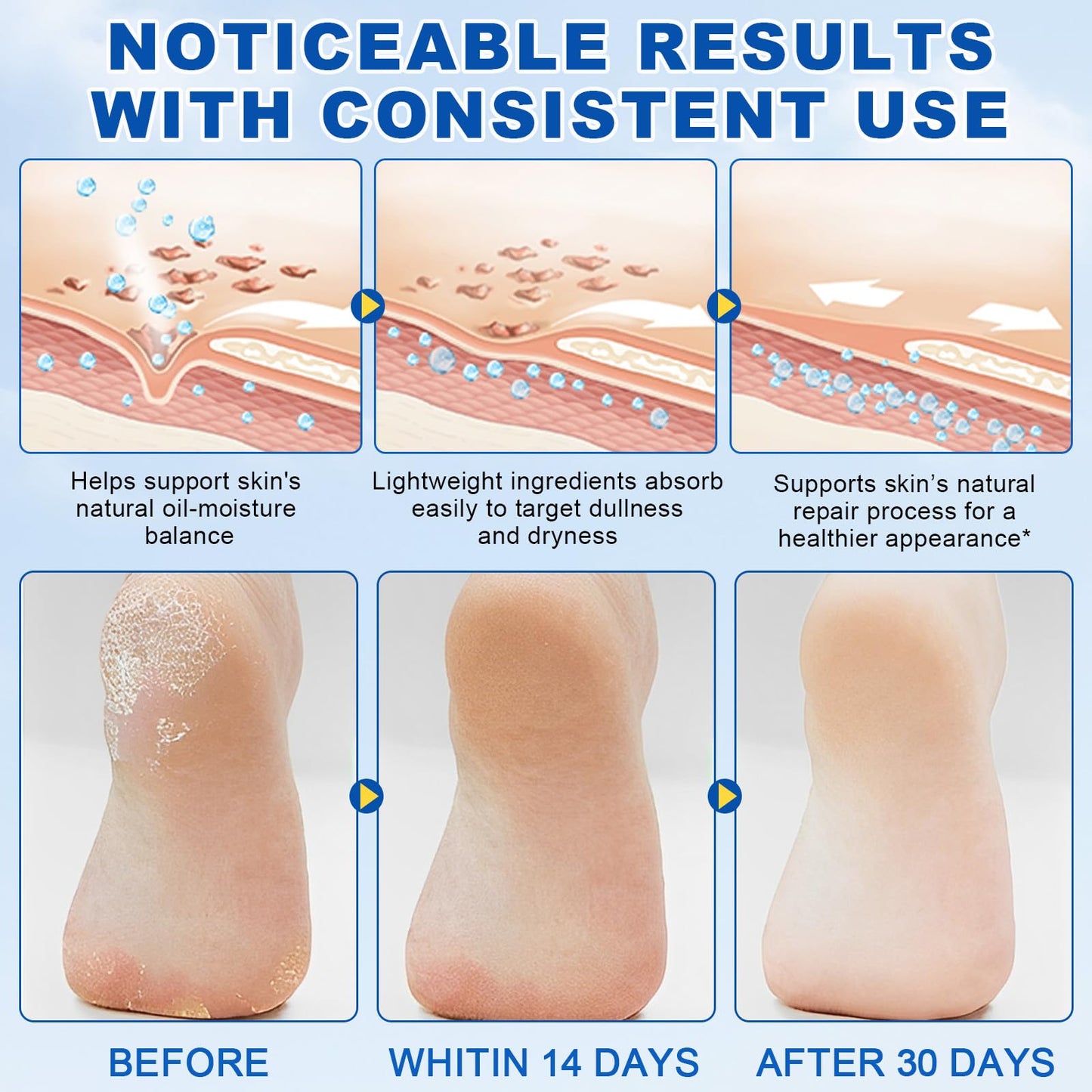 NBXINSLF 60% Urea Cream Foot Care Stick and Manuka Honey Moisturizing Stick, Moisturizer Cream for Dry Cracked Feet, Knees, Elbows, Hands,Moisturizes and Hydrates the Dry Skin,Callus Remover & Skin Softener