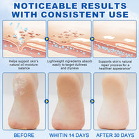 NBXINSLF 2Pack 60% Urea with 2% Salicylic Acid Urea Foot Care Stick, Foot Cream Moisturizer for Dry Cracked Feet, Knees, Elbows, Hands,Moisturizes and Hydrates the Dry Skin,Callus Remover & Skin Softener