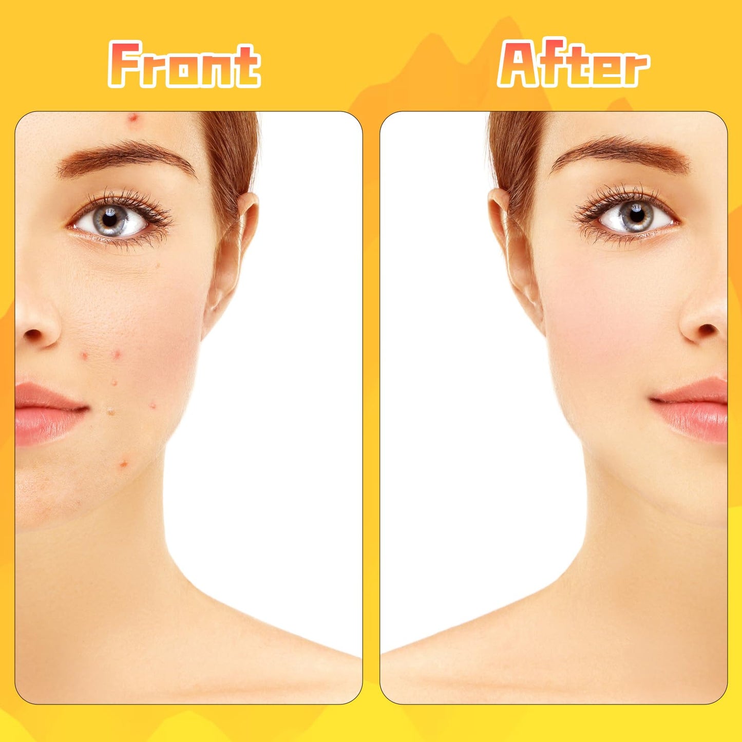 QhgPnt 64Pcs Hydrocolloid Pimple Patches, Cute Star Pimple Patches, Hydrocolloid Pad Sticky Spot Star Covers Face Pimple Patches, Star Pimple Patches Absorb Fluid and Reduce Redness for Face And Skin