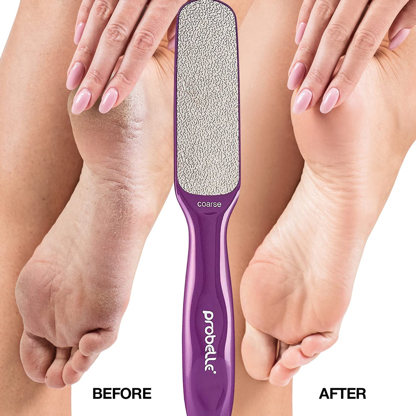 Probelle Double Sided Multidirectional Nickel Foot File Callus Remover - Immediately Reduces calluses and Corns to Powder for Instant Results, Safe Tool (Purple)