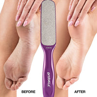 Probelle Double Sided Multidirectional Nickel Foot File Callus Remover - Immediately Reduces calluses and Corns to Powder for Instant Results, Safe Tool (Purple)