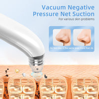 GUPAY Blackhead Remover Vacuum, Pore Vacuum with 1080p HD Camera Visible Facial Pore Cleanser with 4 Suction Heads, 5 Suction Power for Pimple Acne Whitehead Deep Cleansing Remover Tool