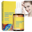 OuXing Dark Spot Remover for Face and Body,Dark Spot Remover Serum,Dark Spot Corrector,Sun S/pot and Age S/pot Remover,Freckle Removel Cream,Hydrating Serum,Brightening Serum,Skin Serum,Facial Serum