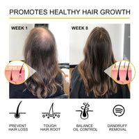 Hair Growth Serum Anti Hair Loss Hair Serum Ginger Regrowth Hair Oil For Thinning Balding,Thin Hair,Fast Growth,Repairs Follicles Stronger Hair For Men & Women,35ml (1pc)