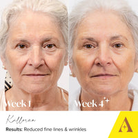 Absolute Collagen Deep Lift Day Cream SPF30 - Hydrating Face Moisturiser with UVA/UVB Protection - Collagen Boosting Formula Increases Skin Elasticity, Evens Skin Tone, Smooths & Firms - Anti-Ageing