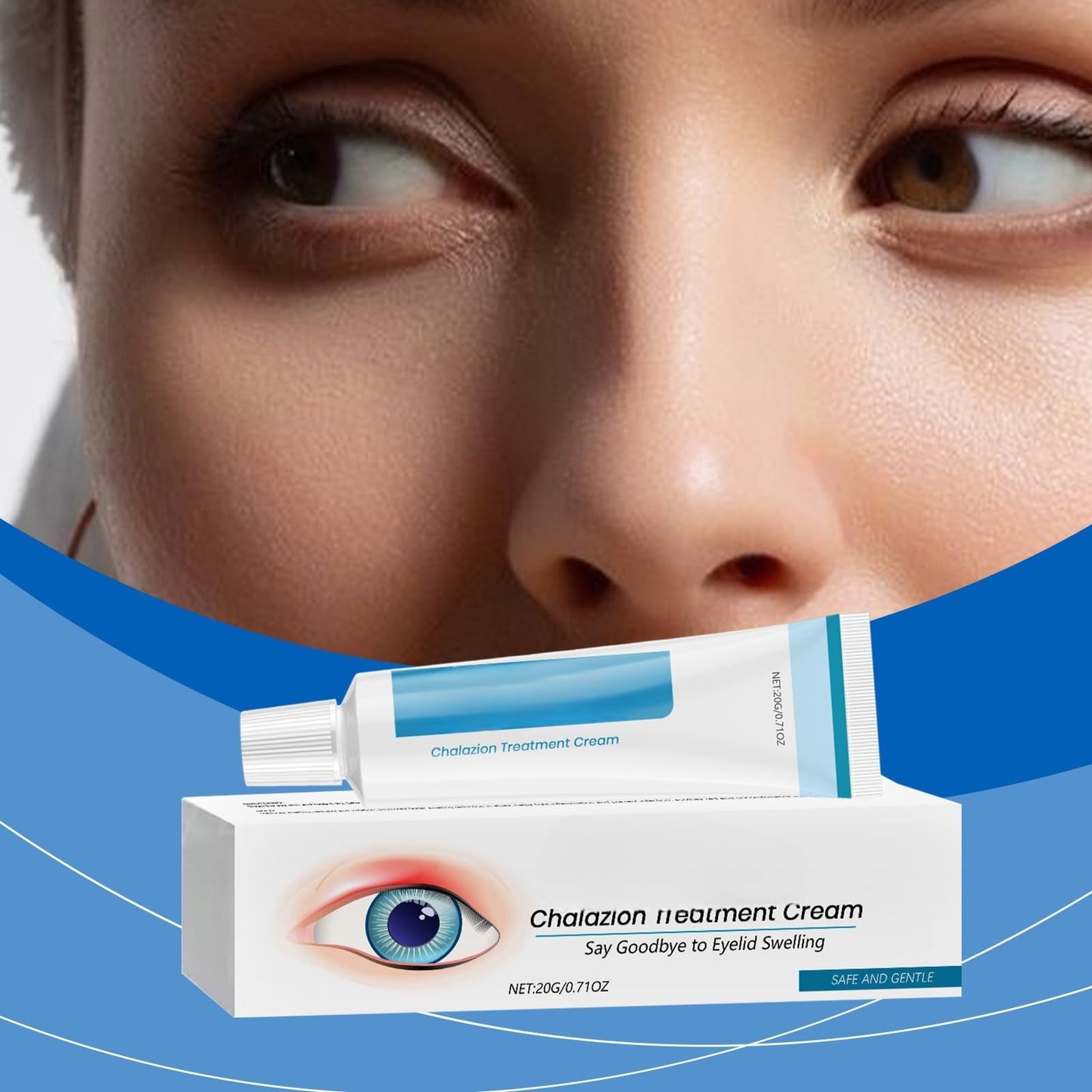 2PCS Chala/zion Eye Treatment Cream,Stye Eye Treatment,Moisturizing Cream for Eyelids,Stye Treatment for Dry Eyes,Cha/lazion Treatment for St/ye,Gentle Eyelid Cre/am for Daily Eye Care,S/tye Eye