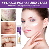 Azelaic Acid Cream,Azelaic Acid Face Cream,Azelaic Acid Serum,Azelaic Acid 12% Facial Serum,Facial Serum Cream,Niacinamide & Vitamin C Face Cream,For All Skin Types (20g)