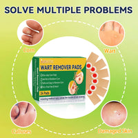 AstraVox Wart Remover, 24pcs Corn Remover for Feet and Hand, Verruca Treatment Plasters for Kids Adults, Wart Treatment Effective Way, Pain Relief, Repair Skin, Easy to Use