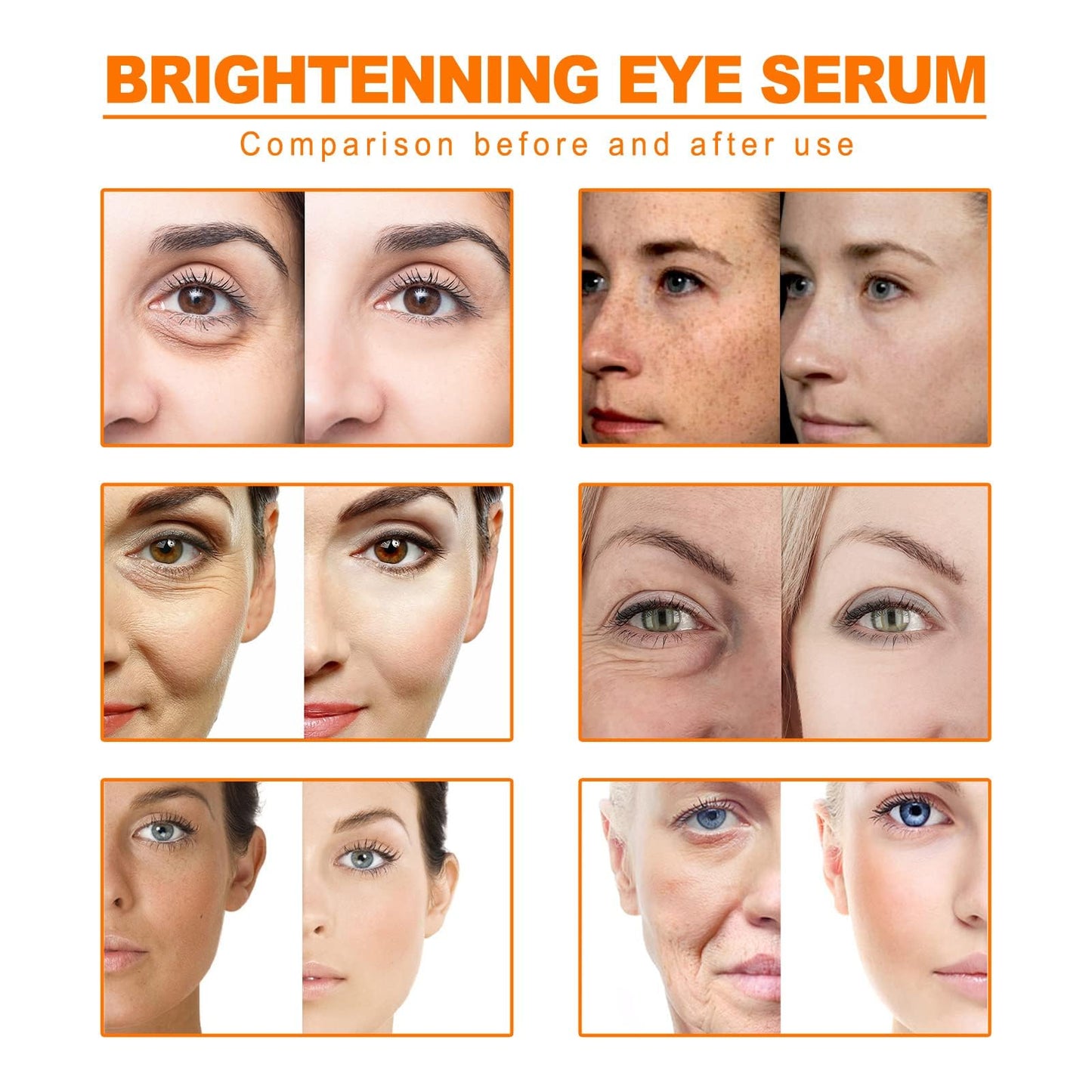 KKwoter Turmeric Oil Facial Serum - Diminish Spots, Illuminate, Moisturize. Improves Skin Tone. For all Skin Types (10ML)