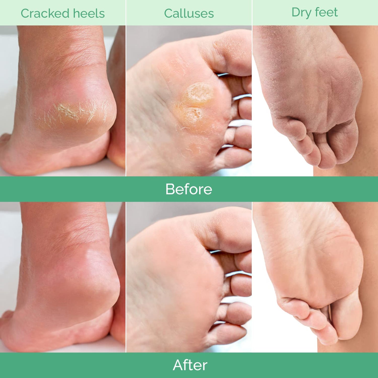 PLANTIFIQUE Plantifique Foot Peel Mask – 2 Pairs Exfoliating & Dermatologically Tested Foot Treatment, Removes Dead Skin & Repairs Heels for Soft Feet – Peach Scent, Gift for Women & Men