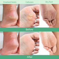 PLANTIFIQUE Plantifique Foot Peel Mask – 2 Pairs Exfoliating & Dermatologically Tested Foot Treatment, Removes Dead Skin & Repairs Heels for Soft Feet – Peach Scent, Gift for Women & Men