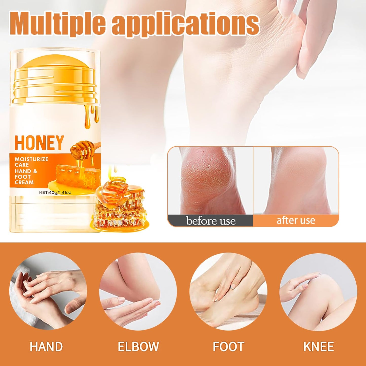 FresFresi Honey Foot Cream – Moisturizer for Dry Hands & Cracked Heels. Deep Repair & Hydration for Rough Skin – Fast-Absorbing Formula for Women & Men