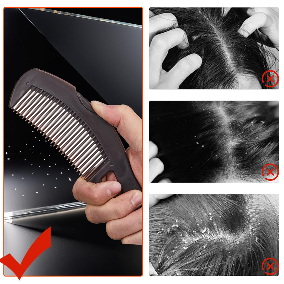 Yizerel Dandruff Comb, Stainless Steel Fine Tooth Comb, Scalp Psoriasis Comb, Dandruff Remover Comb Scalp Sweep Detoxing Comb, Lice Comb for Scalp Massage Combs for Women Men, Set of 3