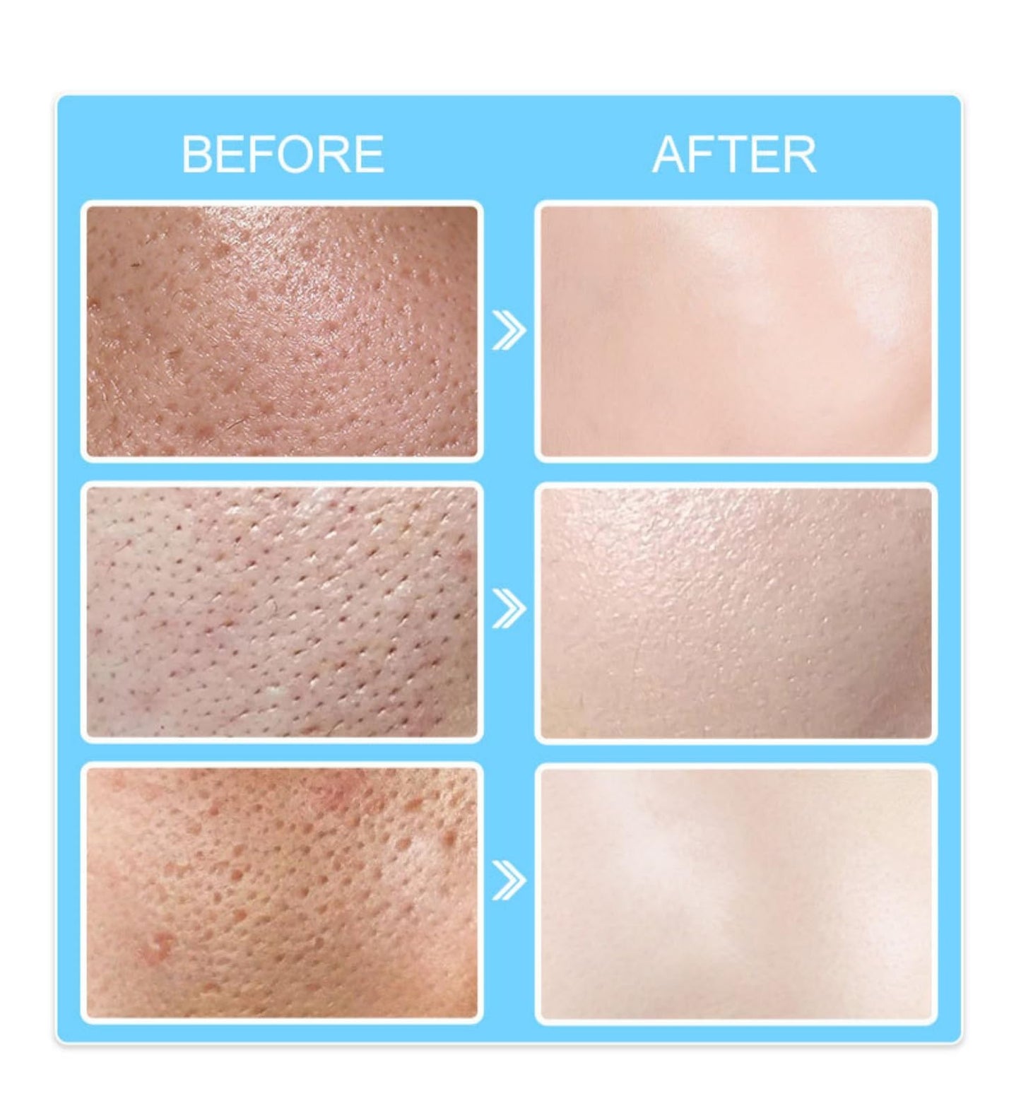 SinceReal Pore Invisible Cream, Pore Shrinking Invisibility Cream, Pores Minimizer & Reducer for Face, Smooths Conceals, Oil Control Firming, Hydrates