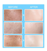 SinceReal Pore Invisible Cream, Pore Shrinking Invisibility Cream, Pores Minimizer & Reducer for Face, Smooths Conceals, Oil Control Firming, Hydrates