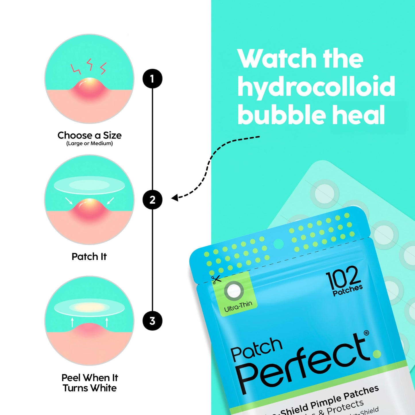 Patch Perfect Spot Patches (102 Count) - Korean Hydrocolloid Pimple Patches, Absorbing Dots for Spot Treatment, Invisible Acne Patches, Vegan & Cruelty-Free Spot Stickers (2 Sizes)