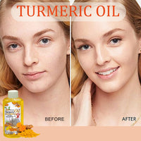Turmeric Oil for Skin Massage Oil - Hydrating Moisturizing Body Oil - Face Oil for Dry Skin Uneven Skin Tone - Turmeric Massage Oil for Face and Skin Care - Anti Dark Spots Anti-Oxidation Anti-Aging