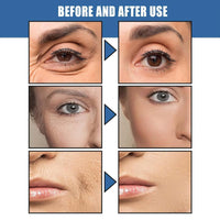 QEUTKEZS Anti-Aging Face Cream,5 Seconds Instant Wrinkle Removal Cream,with 2.5% Retinol Anti-Wrinkle Cream Skin Firming Lifting Moisturizing Facial Cream Remove Fine Line Skin Care