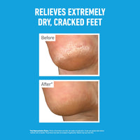 O'Keeffe's O’Keeffe’s Healthy Feet Overnight 80ml – Intensive Moisturising Foot Cream for Dry, Cracked Heels | Cracked Heel Repair Cream