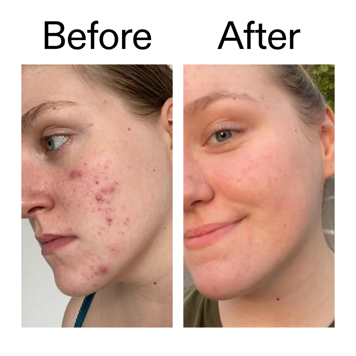 The INKEY List 15% Vitamin C and EGF Serum Helps to Intensively Brighten All Skin Types 30ml