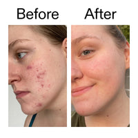 The INKEY List 15% Vitamin C and EGF Serum Helps to Intensively Brighten All Skin Types 30ml