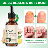 Tea Tree and Ginger Nail Fungus Treatment, Tea Tree Oil for Nail Fungus, 7 Days Fungal Nail Treatment for Toenail, Cuticle Care Oil, Nail Strengthener for Damaged Nails, Ginger Nail Serum