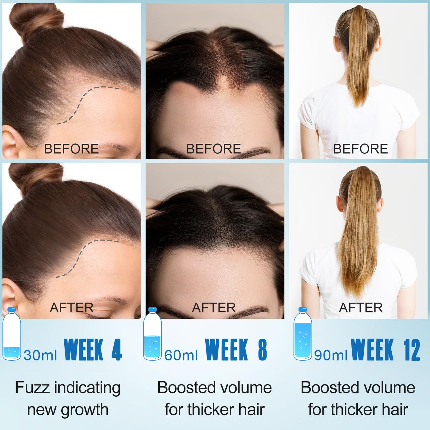 GoldWorld Rosemary Oil for Hair Growth,2 Pack Hair Growth Oil,Diluted Rosemary Oil and Hair Serum for Dry Damaged Hair,Proven Hair Loss Treatment & Hair Thickening Products,Gifts for Women Men