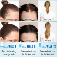 GoldWorld Rosemary Oil for Hair Growth,2 Pack Hair Growth Oil,Diluted Rosemary Oil and Hair Serum for Dry Damaged Hair,Proven Hair Loss Treatment & Hair Thickening Products,Gifts for Women Men