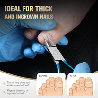 FERYES Ingrown Toenail Clippers Straight Blade Toe Nail Clippers for Thick Nails for Seniors, Stainless Steel Nail Clippers for Thick Toenails - Ultra-Slim 16mm Blade Fingernail Clippers