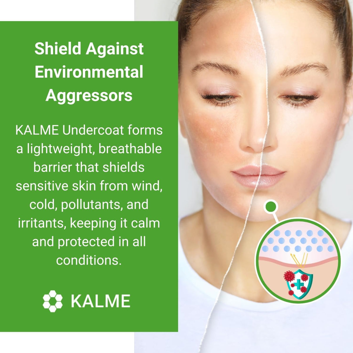 Skin Shop KALME Undercoat – Anti-Redness Primer & Barrier for Sensitive Skin – Lightweight, Fast-Absorbing Protection Against Irritation, Makeup & Flare-Ups (75ml)